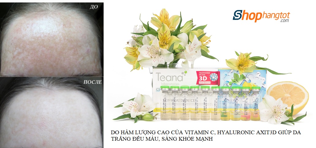 Serum vitamin C teana c1 trang da, ngan nam sam tan nhang, doi moi, tham sam, chay nang