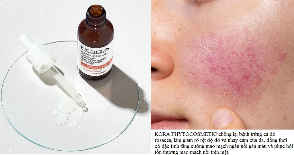 serum cao cap KORA phytocosmetic phuc hoi lam diu cho da nhay cam mong, rosacea, nhiem nam kich ung1