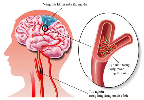 Lưu bản nháp tự động